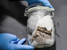 Human brain in a jar seized at US-Canada border by agents
