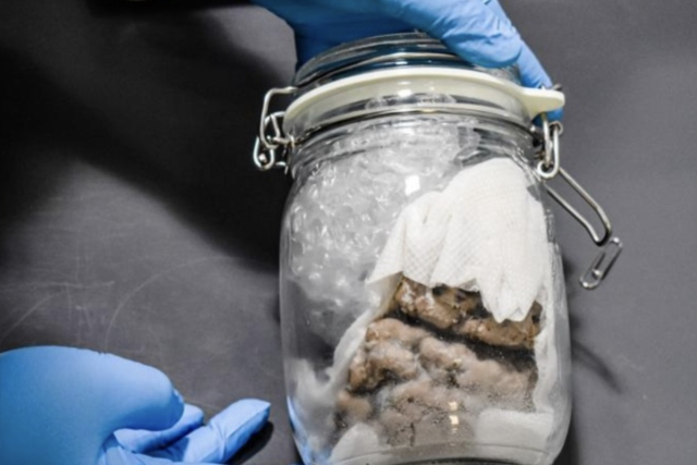A human brain was seized at the US-Canada border on Friday during a routine mail truck inspection