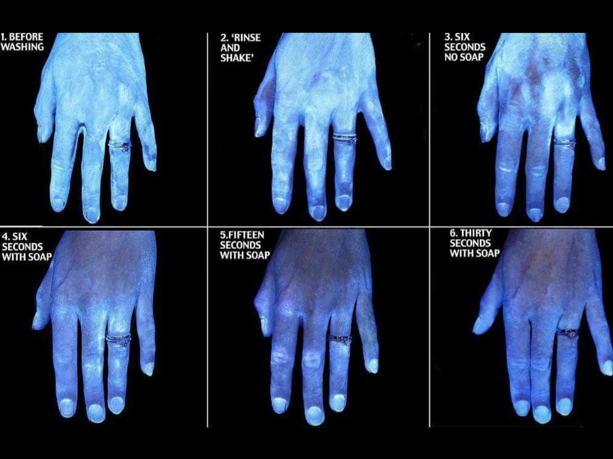 microscopic germs on hands