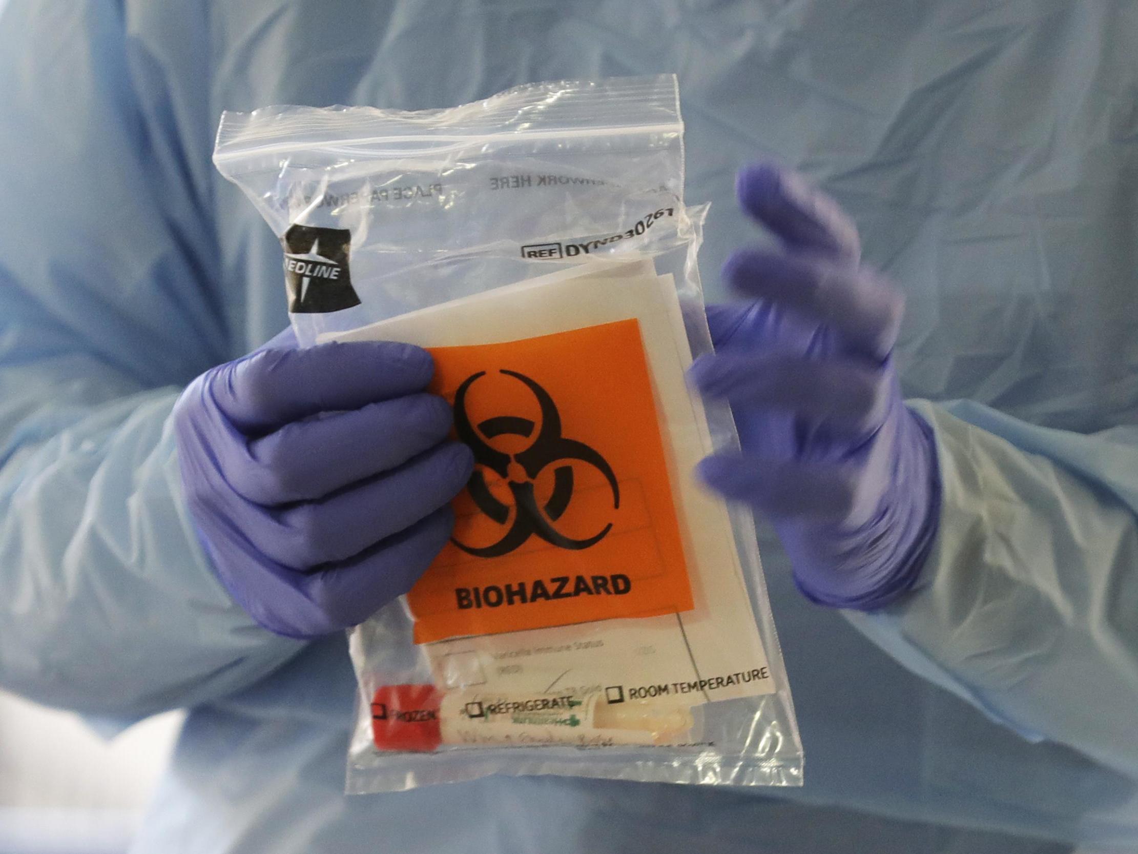 Coronavirus: US hospitals to take drastic measures to help hospitals cope with Covid-19