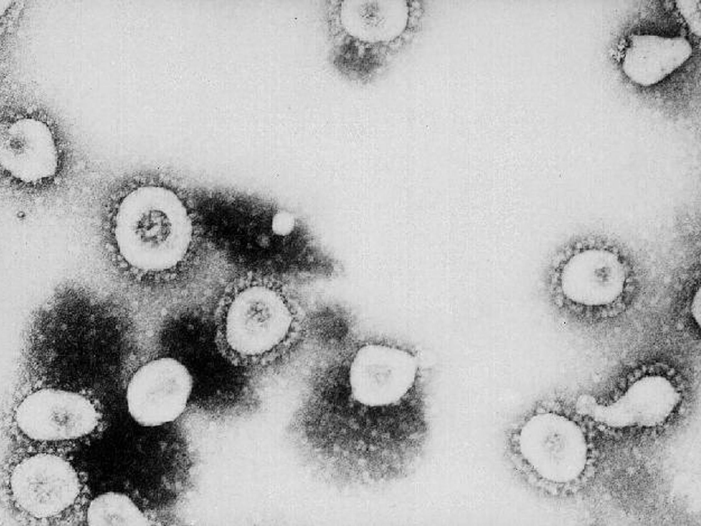 How Does Coronavirus Affect The Body The Independent