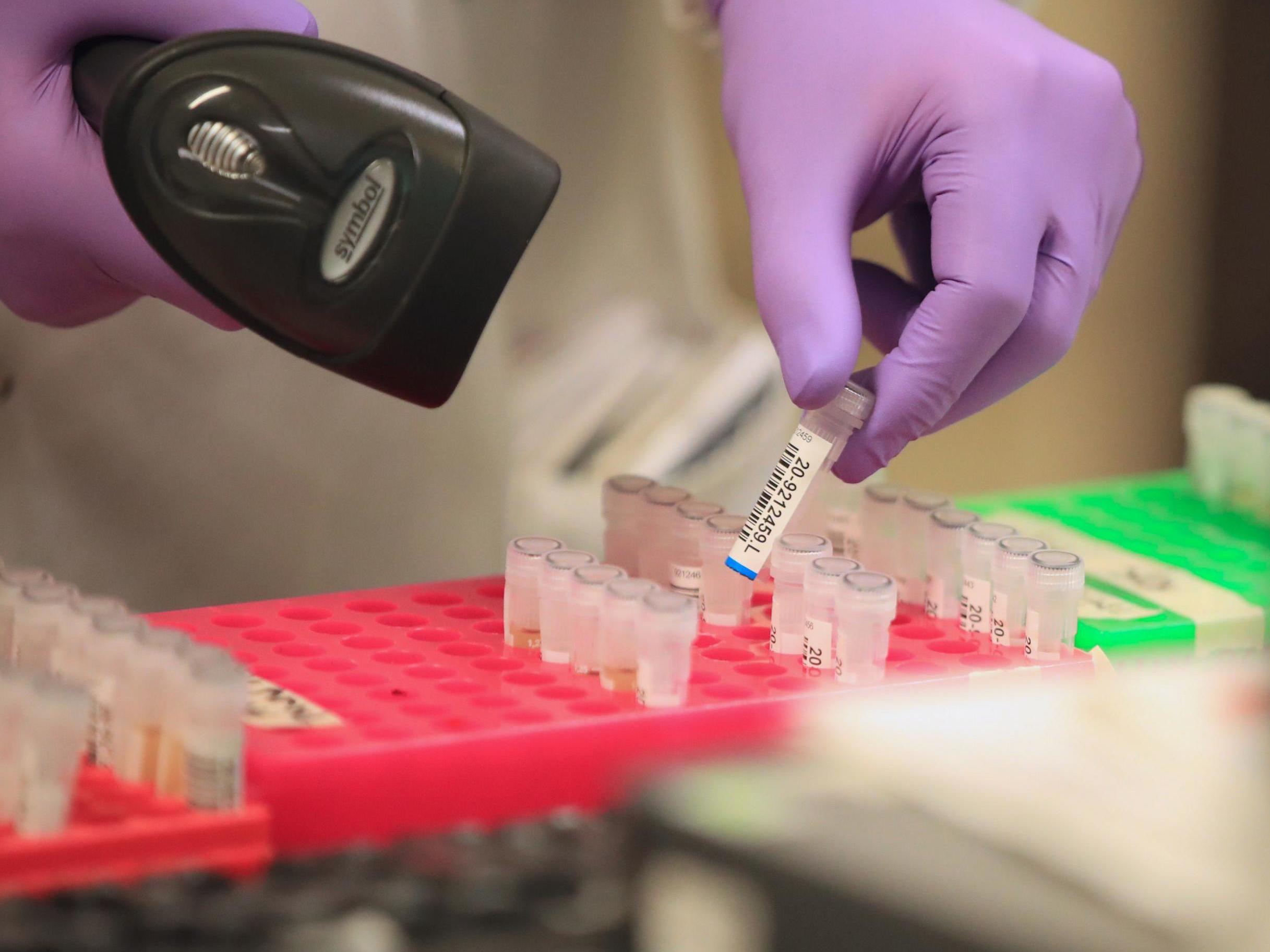 Coronavirus: Private companies ready to provide free testing for frontline NHS staff