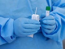 Virus epidemic 'will not overwhelm NHS', says expert