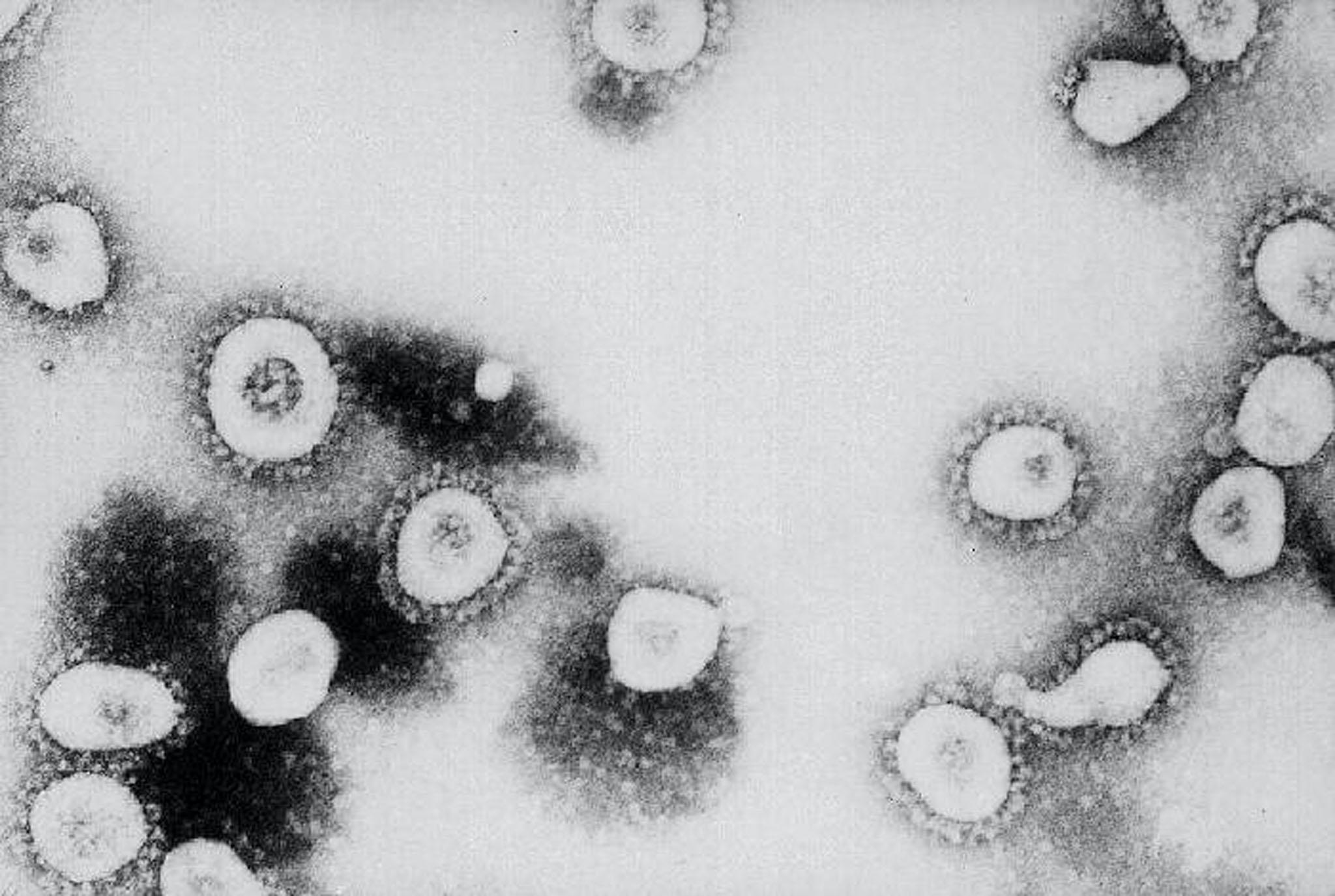 This undated handout photo from the Centers for Disease Control and Prevention (CDC) shows a microscopic view of the Coronavirus at the CDC in Atlanta, Georgia