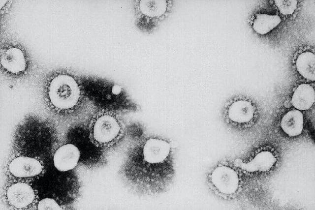 This undated handout photo from the Centers for Disease Control and Prevention (CDC) shows a microscopic view of the Coronavirus at the CDC in Atlanta, Georgia
