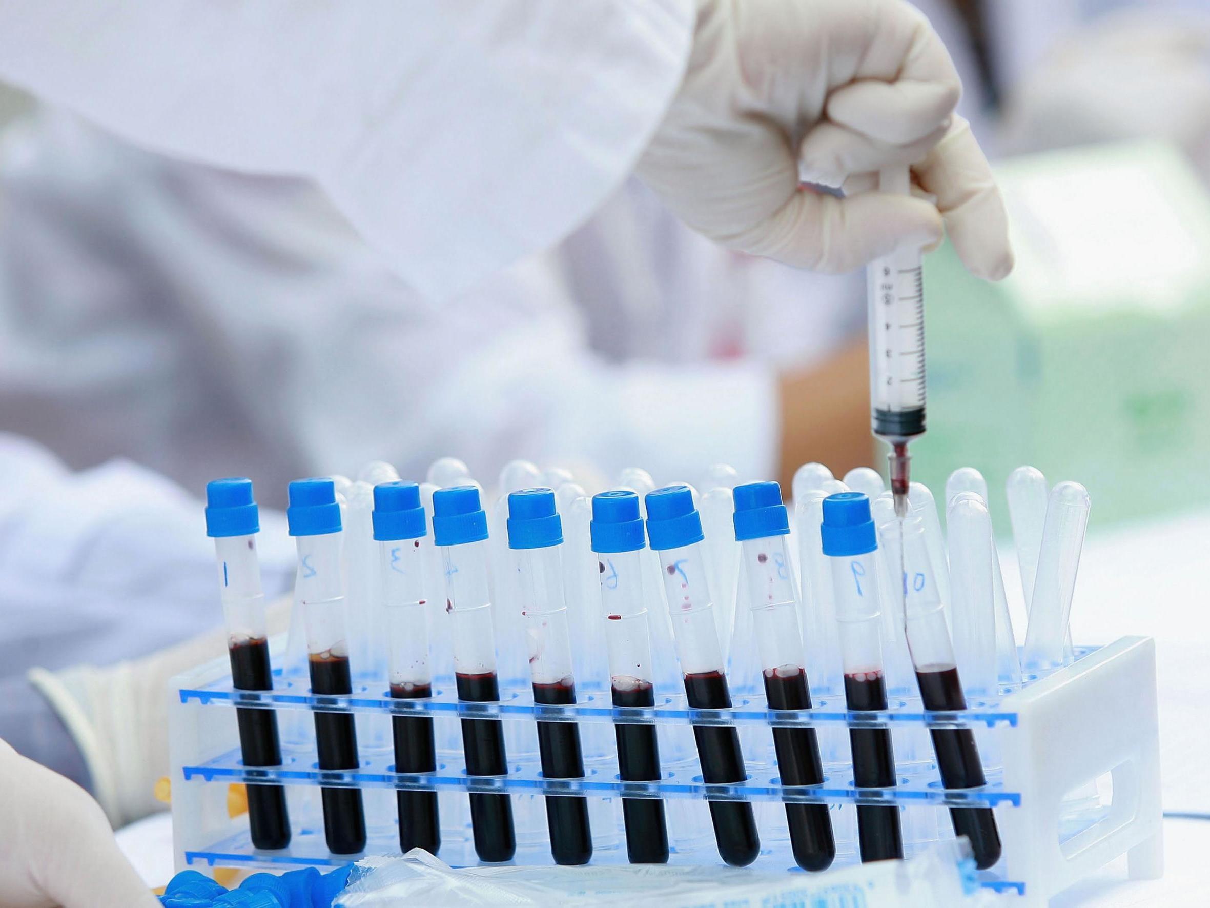 A new blood test is able to detect more than 50 types of cancer