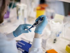 To find a vaccine for coroanvirus, pharmaceutical companies will have to abandon the race for profit