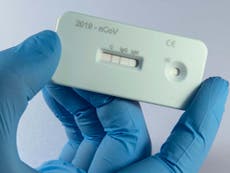 Testing chief admits none of 3.5m coronavirus antibody kits work