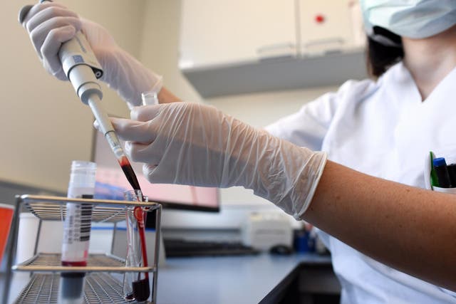 Donated blood and plasma samples are checked if they can used for the production of therapeutic plasma to treat seriously ill coronavirus patients in Germany