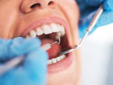 Dental body: Government must act to avoid spike in ‘DIY’ procedures