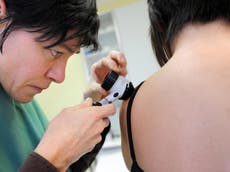 5 skin conditions linked to coronavirus identified by dermatologists