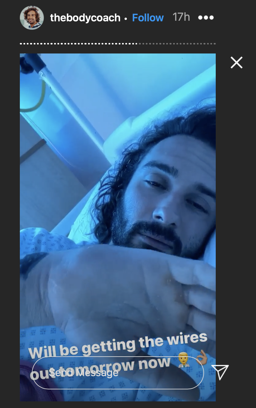 Joe Wicks is scheduled to undergo surgery on his hand on Saturday (Instagram: @thebodycoach)