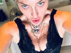 Madonna to undergo ‘regenerative treatment’ to treat knee pain