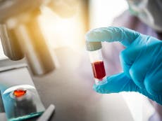 How to get a coronavirus antibody testing kit