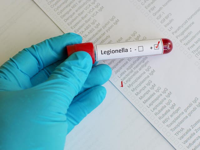 Blood sample with legionella positive