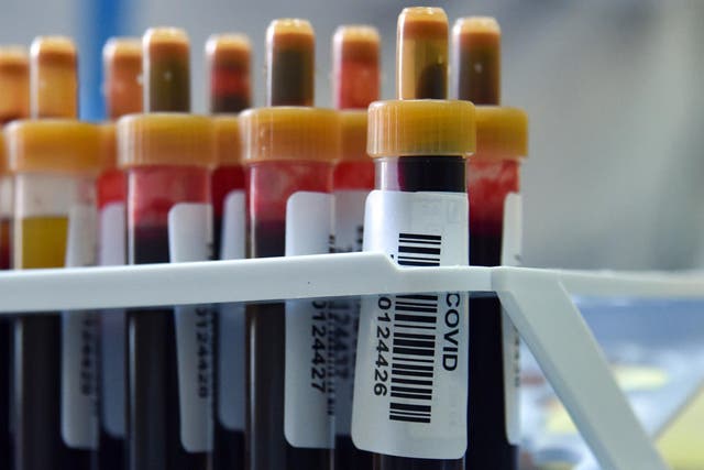 Blood samples to test for COVID-19 antibodies sit on a table at a clinic