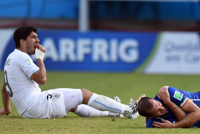 Suarez holds his teeth after biting Chiellini