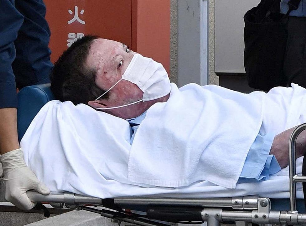 Shinji Aoba, a suspected arsonist who is suspected of killing 36 people at Kyoto Animation in July 2019, is seen on a stretcher as he is carried to Fushimi police station after being arrested in Kyoto