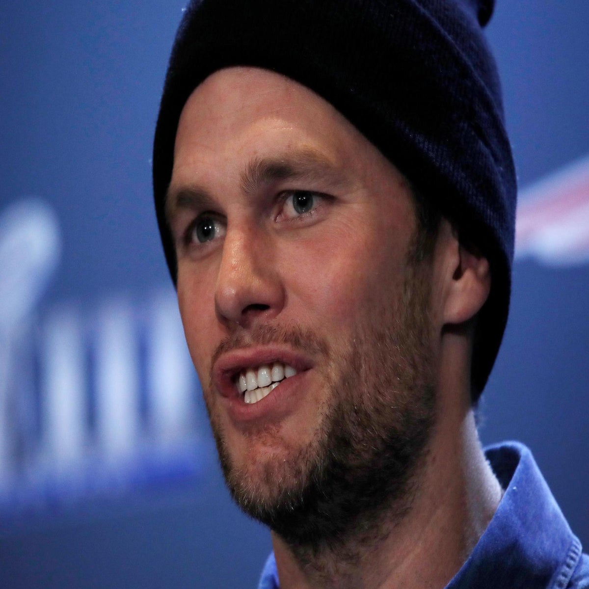 Photos: Tom Brady is selling his custom Cadillac Escalade