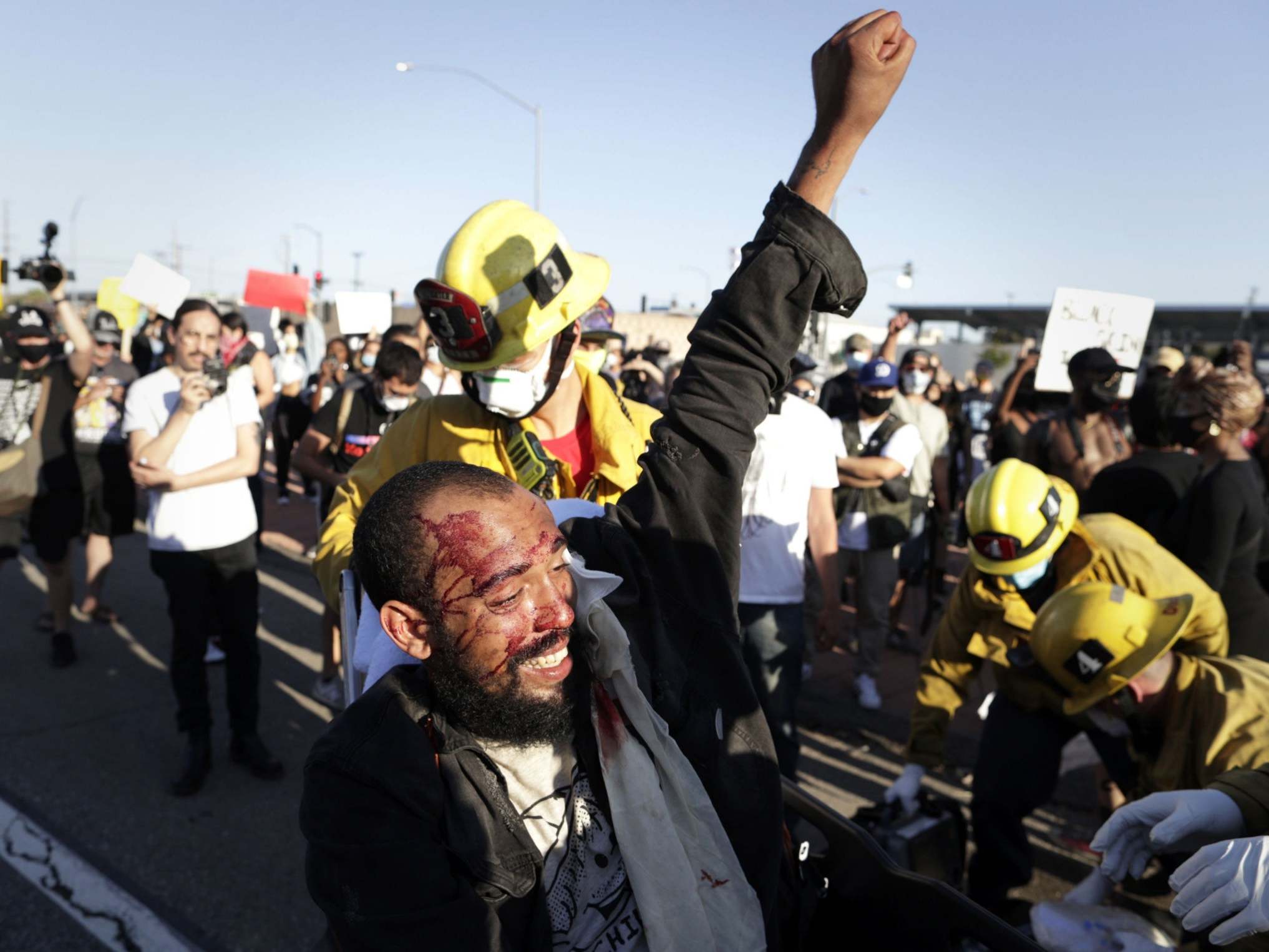 Man helped by fire department following protest in Los Angeles