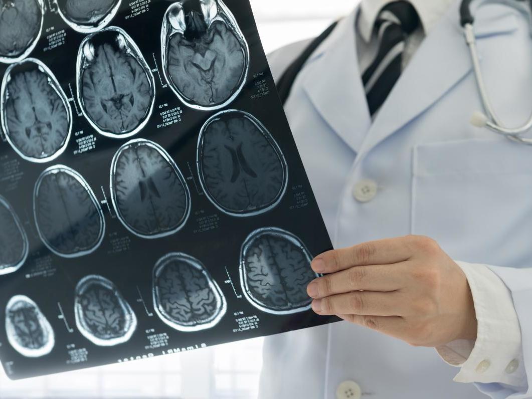 <p>Vorasidenib will not be available on the NHS</p>