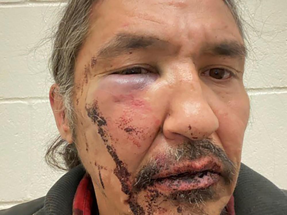 Allan Adam after being arrested by Royal Canadian Mounted Police