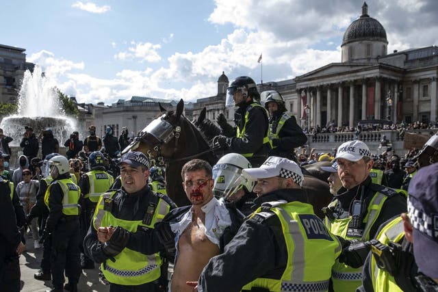 Police lead an injured man away after clashes between Black Lives Matter anti-racism protesters and counter-demonstrators in Trafalgar Square, London, on 13 June 2020.