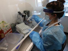 Analysis: Why is there a coronavirus testing shortage?