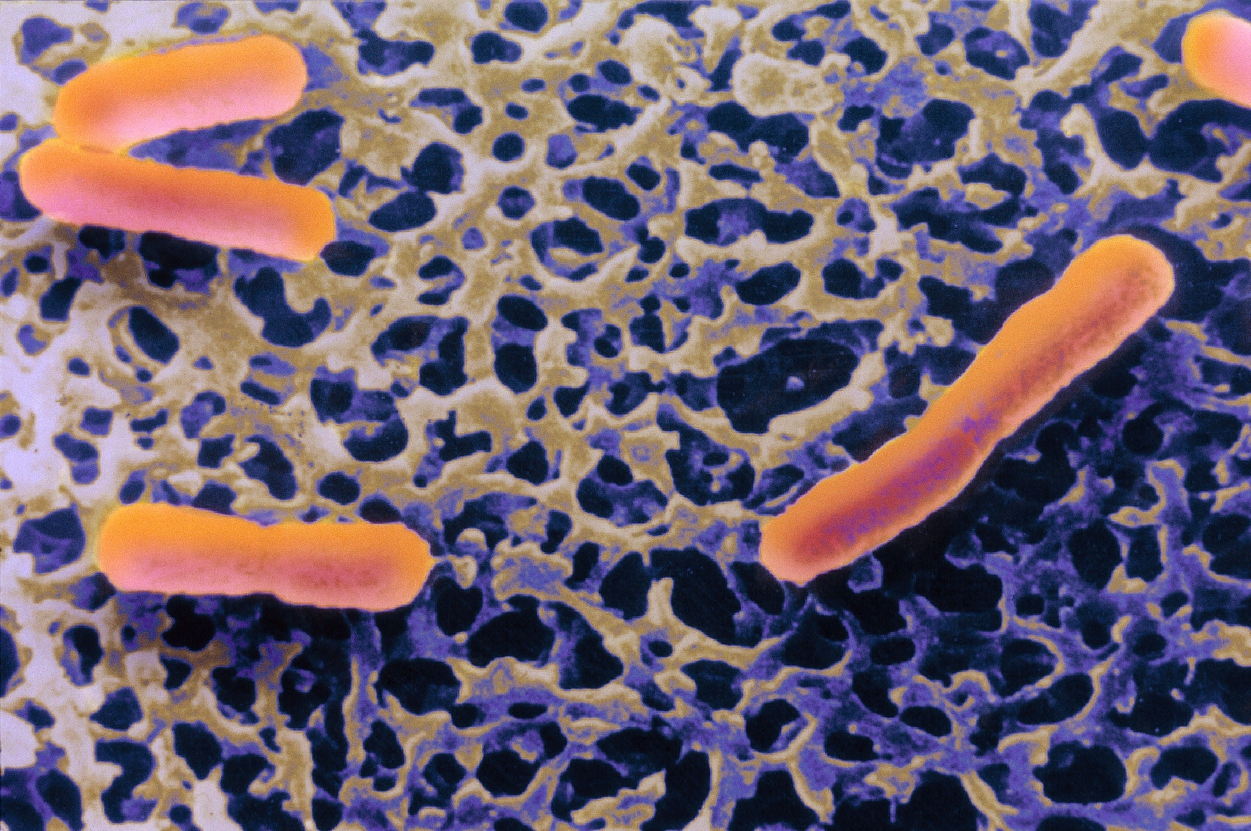 Shigella flexneri, the bacterium that causes dysentery