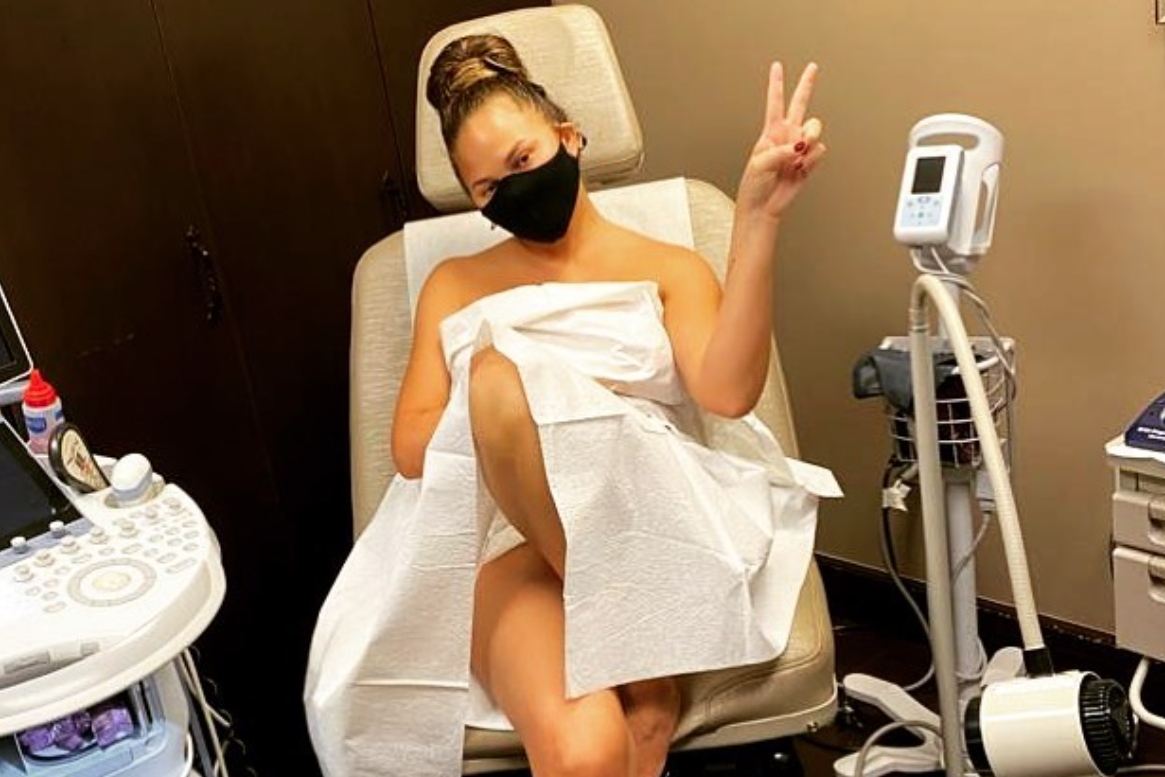 Chrissy Teigen shares photo from pap smear to remind followers to go for check-ups (Instagram)