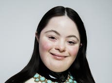 Model with Down’s syndrome stars in Gucci Beauty campaign in Italian Vogue