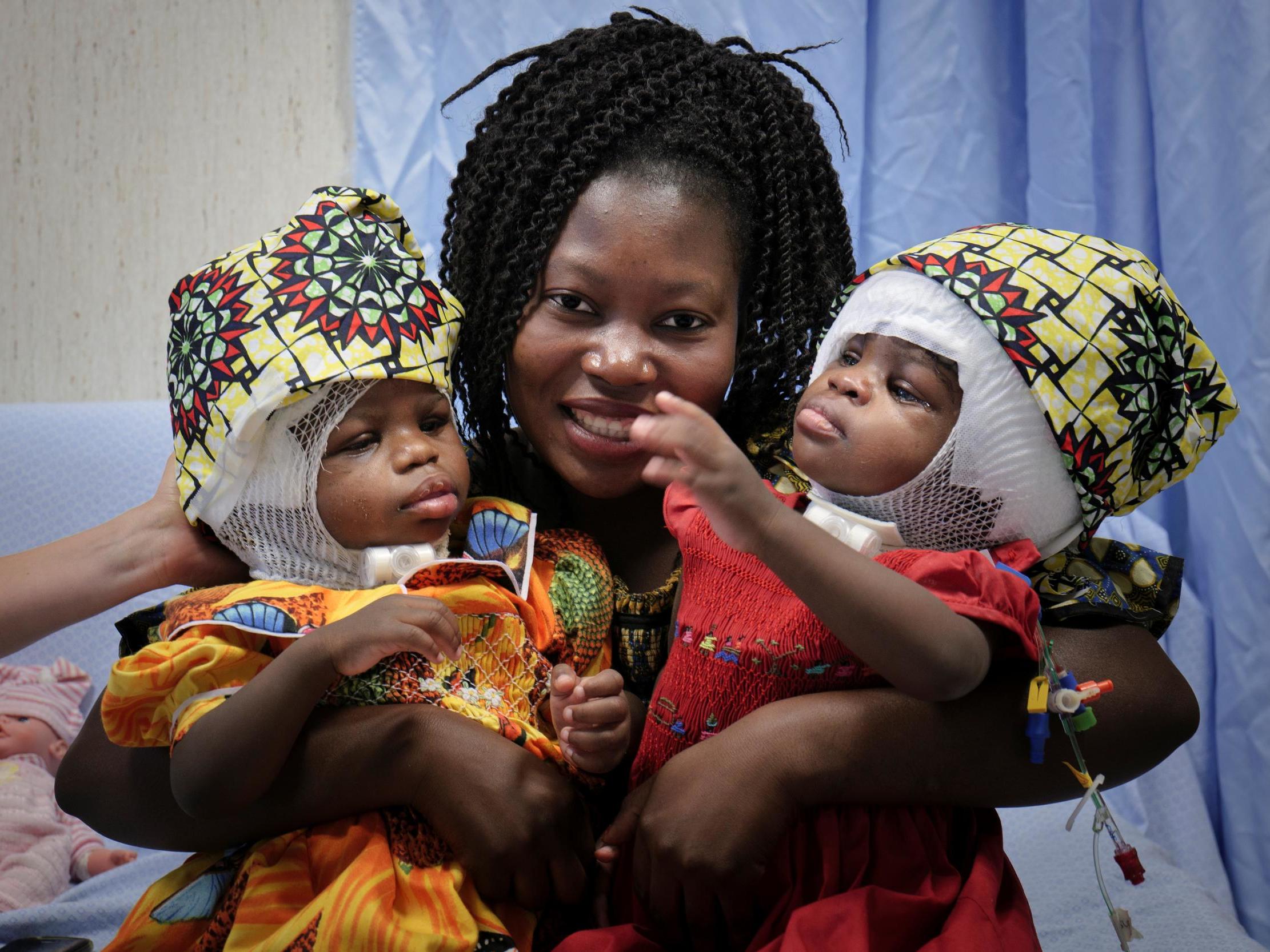 Twin sisters Ervina and Prefina – pictured with their mother Ermine following their surgery – were joined by the head at birth