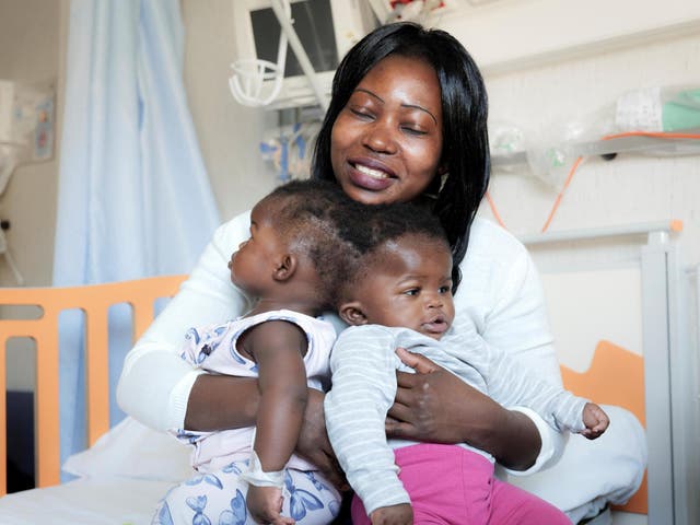 Twin sisters Ervina and Prefina, who had been joined from the back of the head since birth, are pictured with their mother Ermine before going into surgery