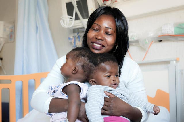 Twin sisters Ervina and Prefina, who had been joined from the back of the head since birth, are pictured with their mother Ermine before going into surgery