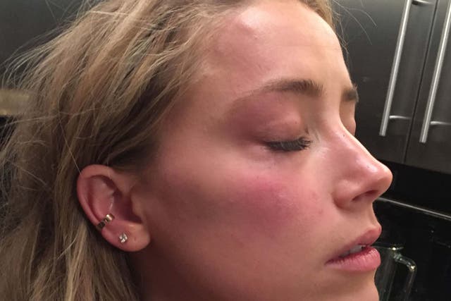 Photo of Amber Heard in May 2016, referred to as an exhibit during Johnny Depp's libel case against The Sun.