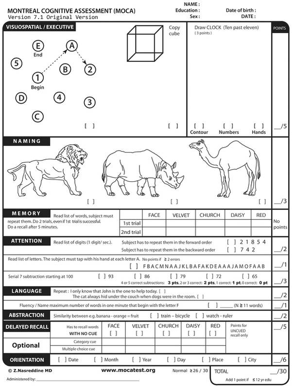 take the montreal cognitive assessment moca