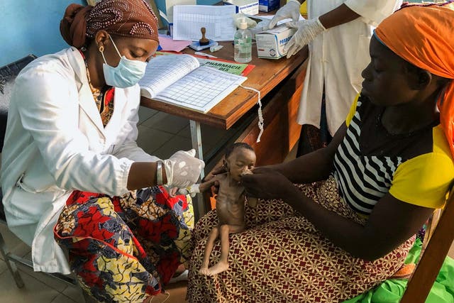 One in five young children in Burkina Faso is chronically malnourished