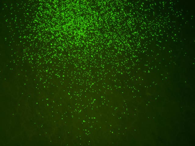 A magnified image showing microbes revived from a 100-million-year-old sediment from beneath the seafloor