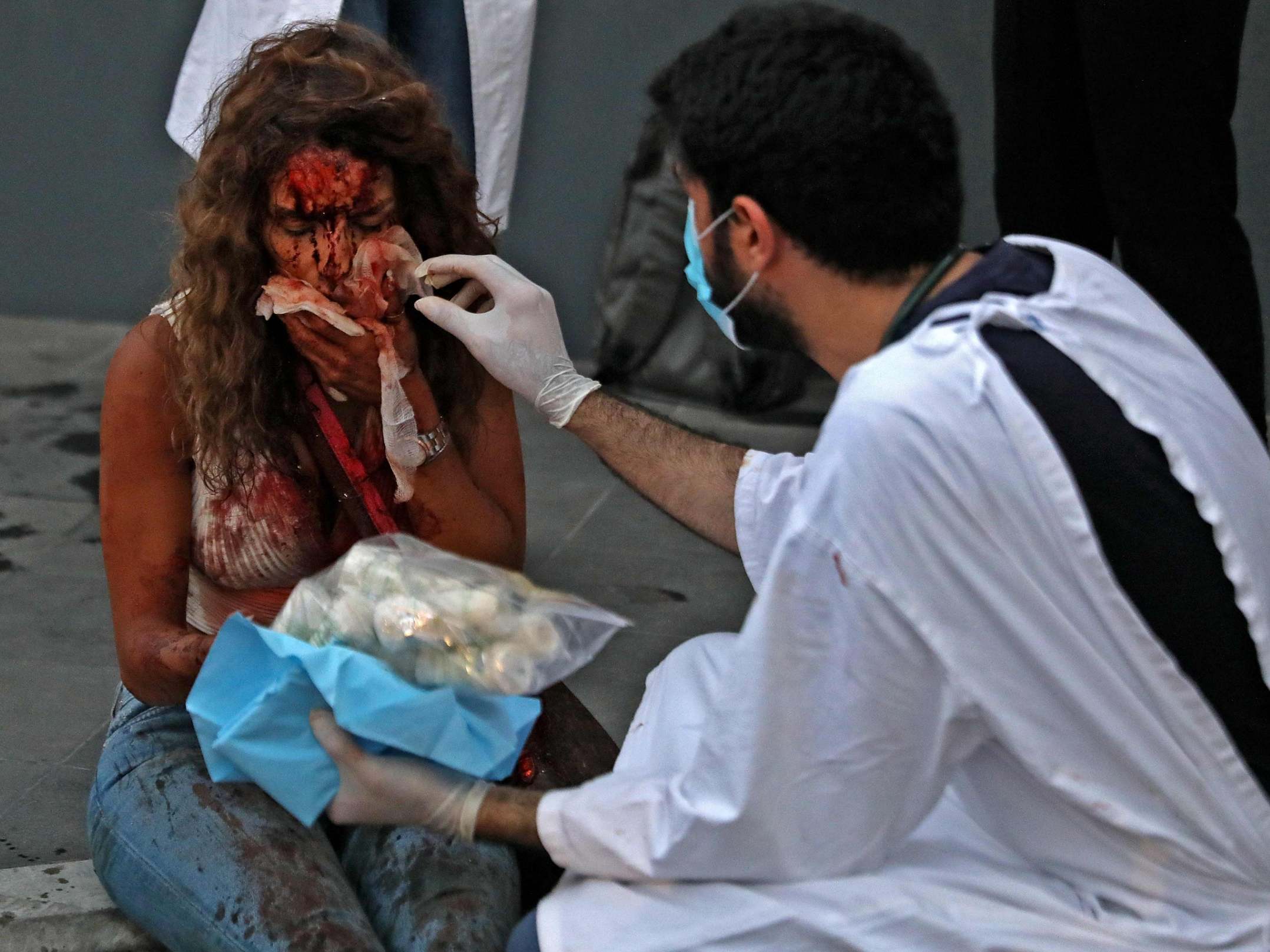 A wounded woman receives help outside a hospital following an explosion in the Lebanese capital Beirut