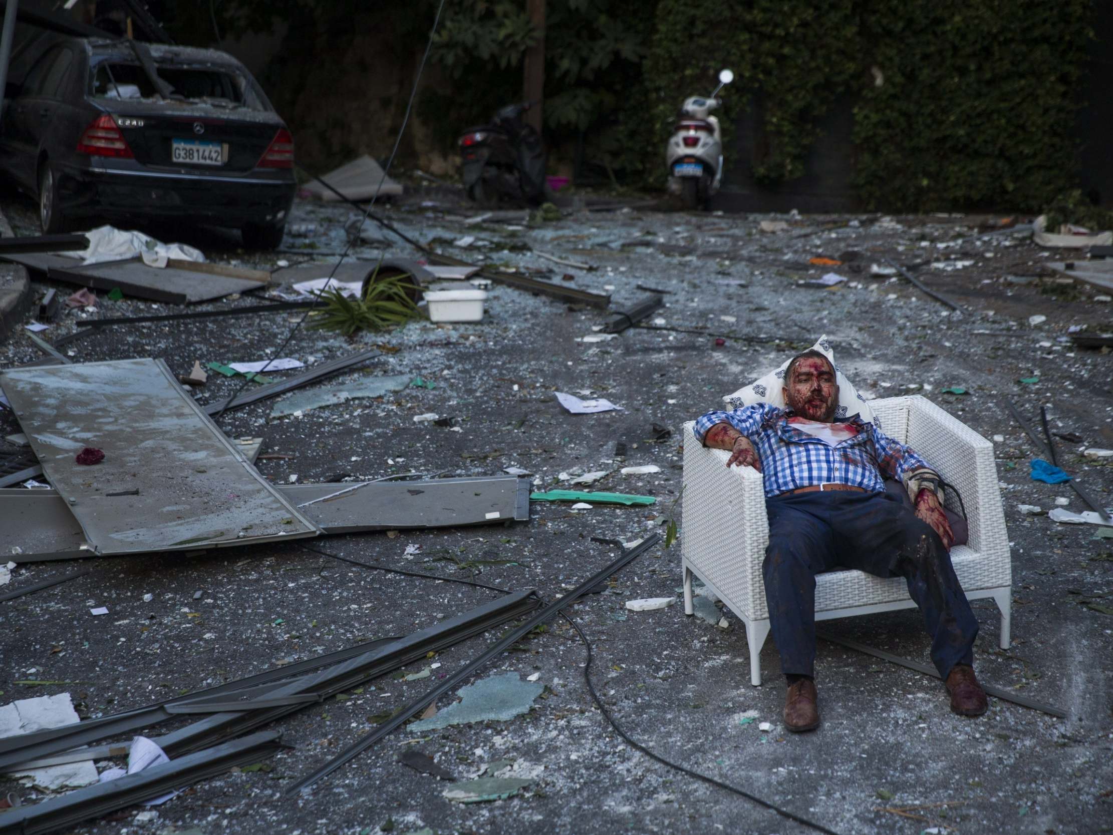 An injured man rests in a chair