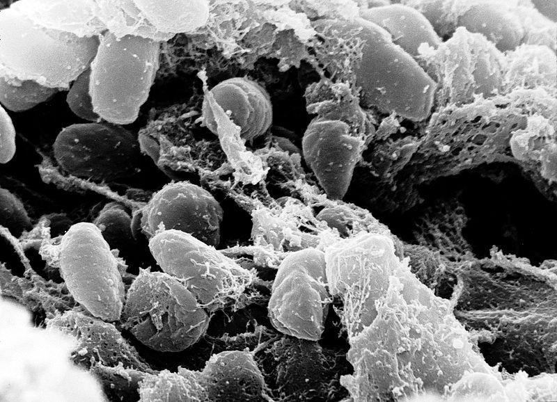 Fleas transmit plague bacteria to humans