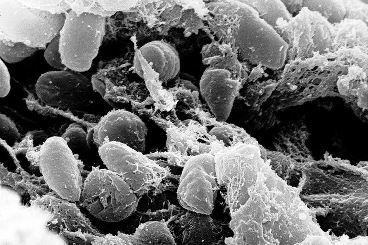 A person in the US has died from the plague. Here’s what you should know