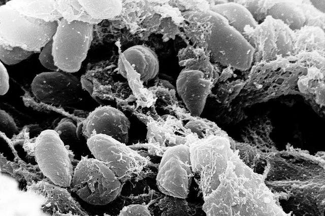 <p>Fleas transmit plague bacteria to humans</p>