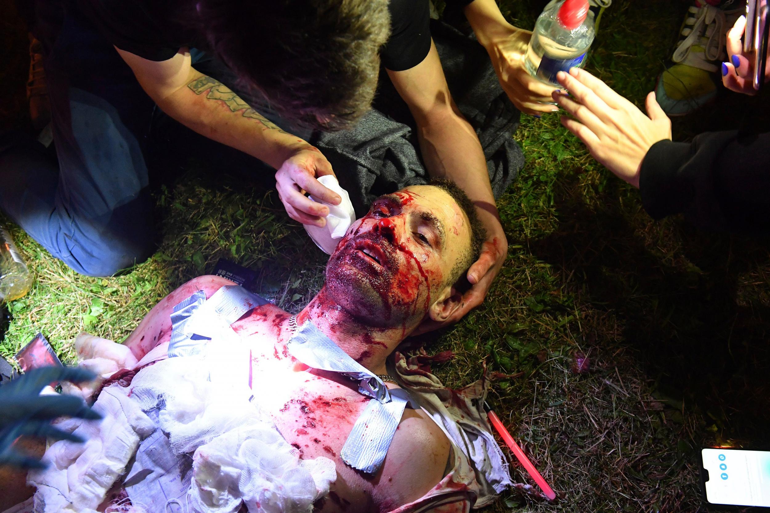 Protesters give aid to a man injured by shrapnel from a smoke grenade during clashes with police