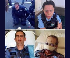 Viral photos of police injured in US protests are from Australia