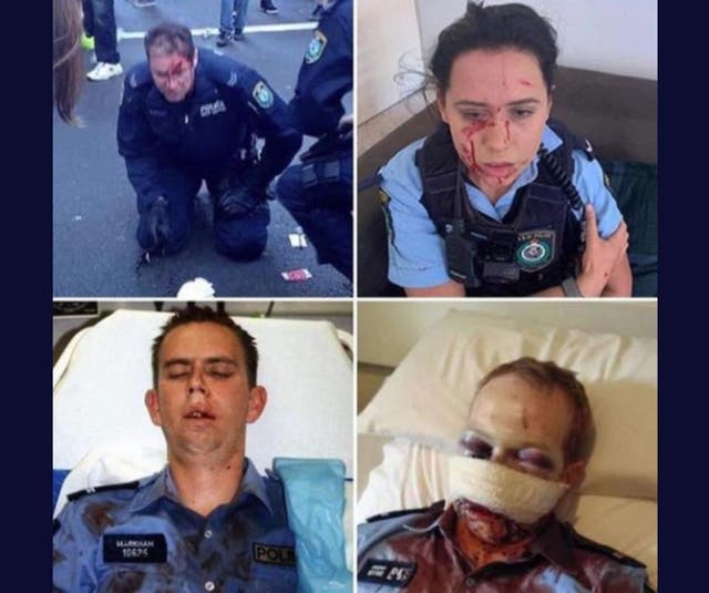 A viral social media post that claims police were injured by Democrats and Black Lives Matter demonstrators. The police are actually Australian and the incidents are years apart.