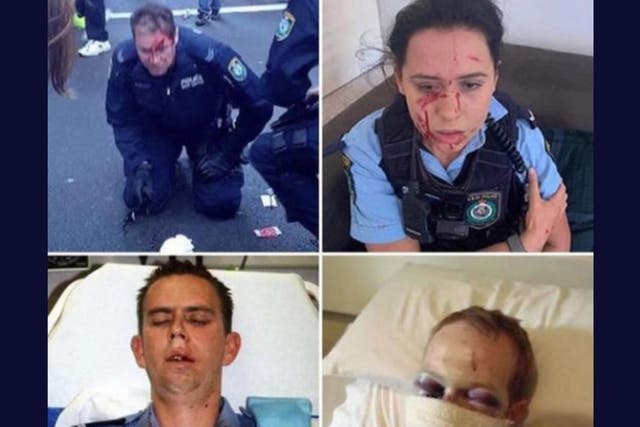 A viral social media post that claims police were injured by Democrats and Black Lives Matter demonstrators. The police are actually Australian and the incidents are years apart.