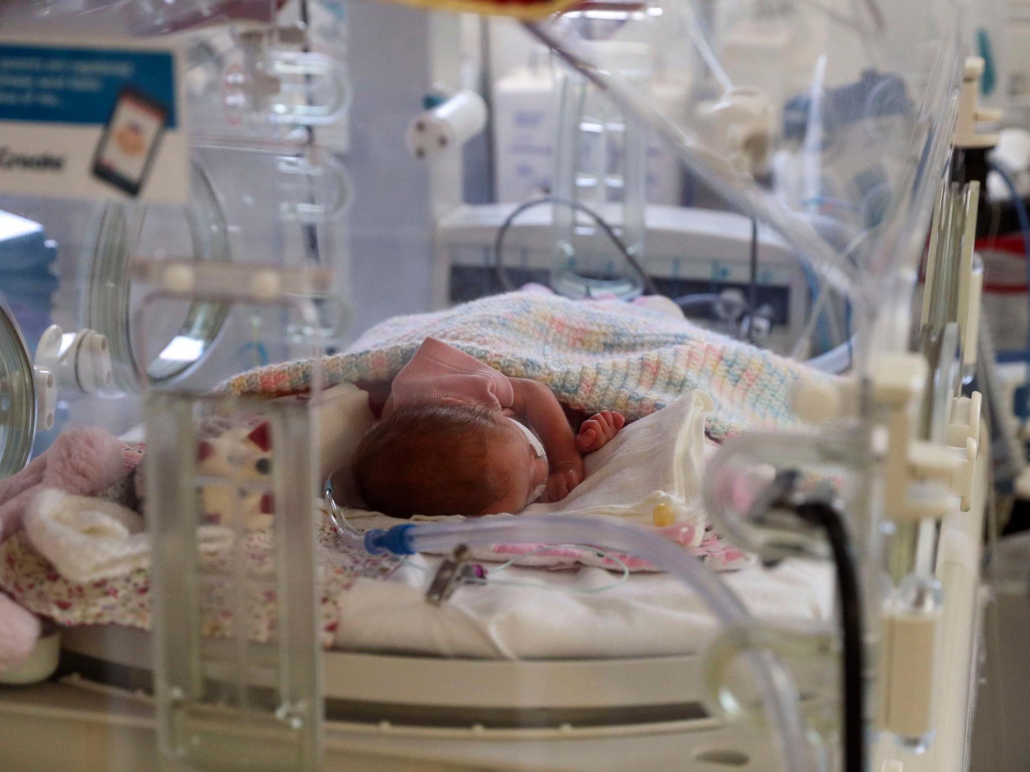 In maternity services, the NHS should have listened to by families more, the executive director said