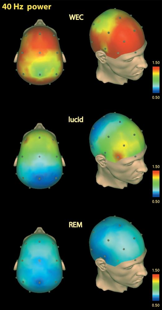 EEG differences in brain activity in the WEC state and REM sleep, compared with brain activity during lucid dreaming [Click to expand]