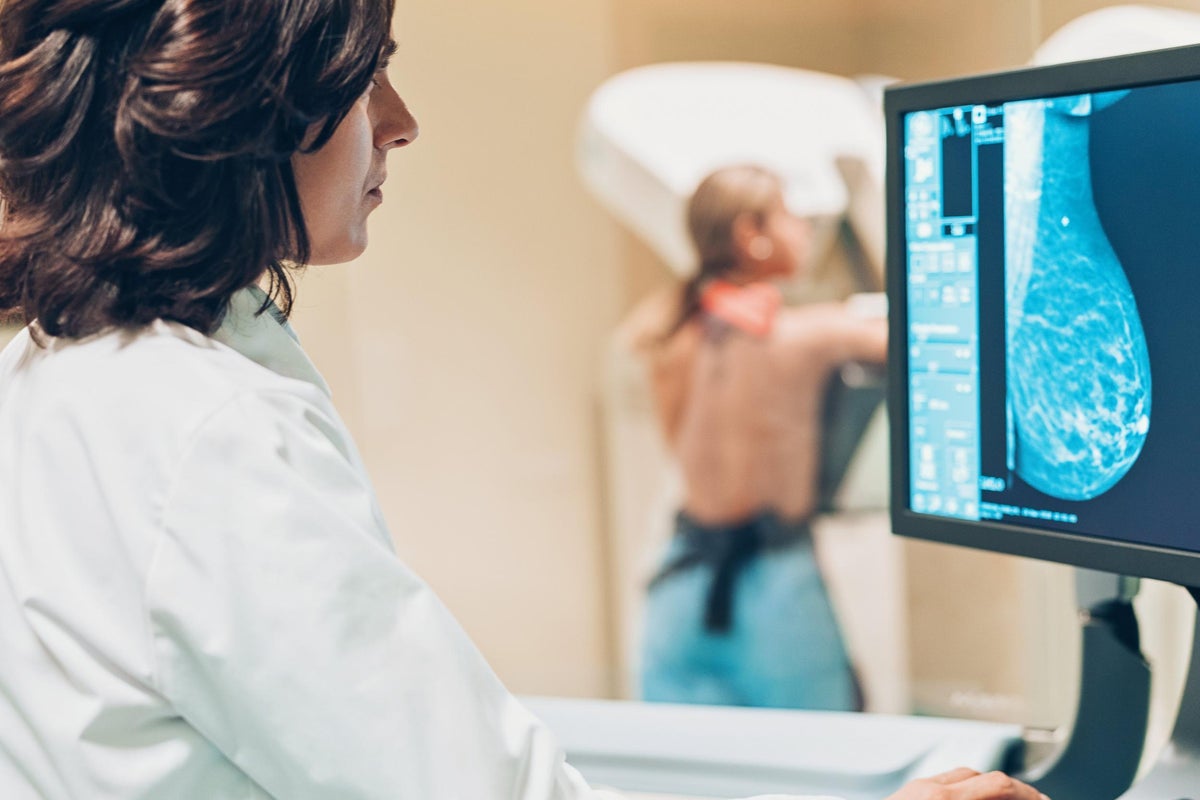 Breast cancer breakthrough raises hopes for disease eradication